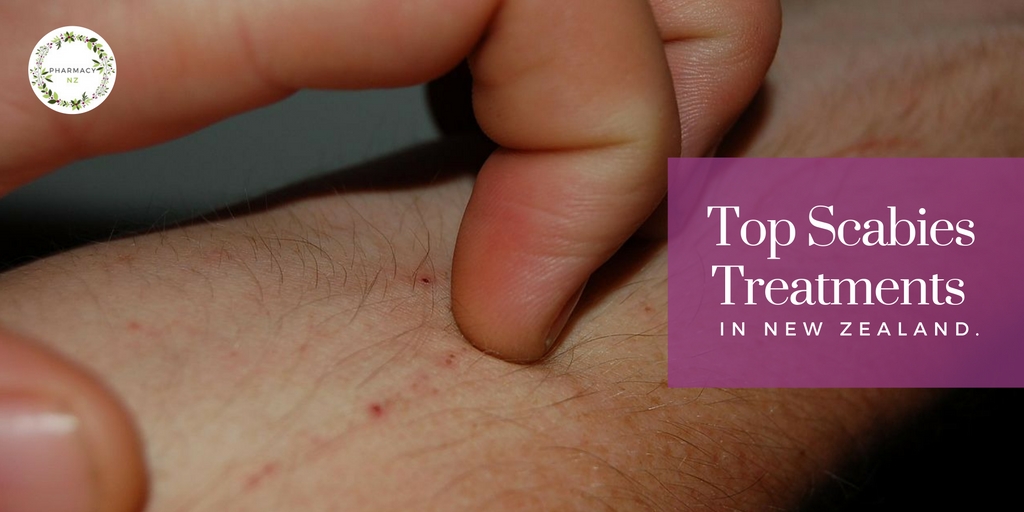Scabies treatment & causes: kids & teens